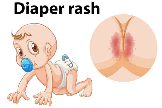 DIAPER RASH